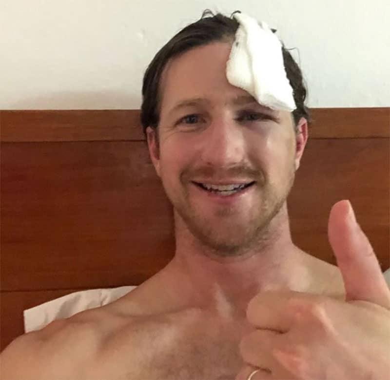 El surfista Matt Bromley luego de su accidente el viernes en Zicatela.